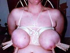 #2 Home Bandage Sample