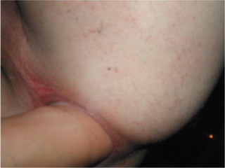 Home Fisting Picture #2